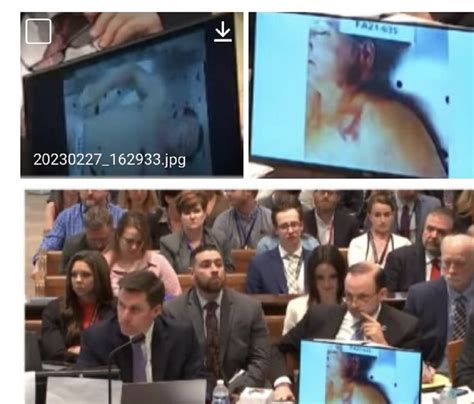 leaked autopsy photos|Alex Murdaugh trial: Autopsy photos shown, and witnesses paint。